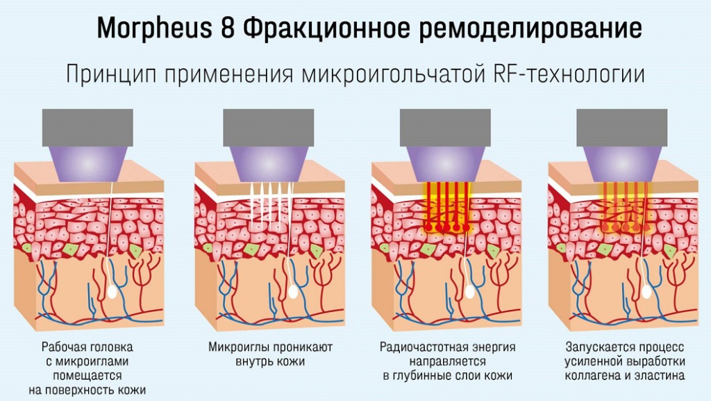 infografiki_inf_5-min-1903x984-1.jpg